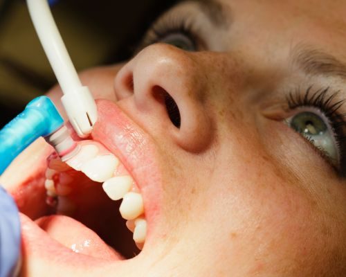 limpieza bucal